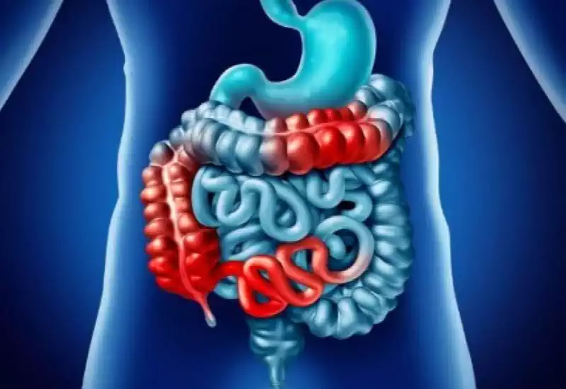 Bağırsak Temizliği Şart